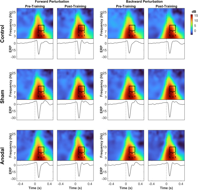 Effect of transcranial direct current stimulation over the primary motor cortex on short-term balance acquisition in healthy individuals.
