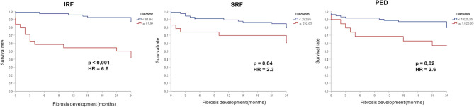 Automated fluid monitoring to optimize the follow-up of neovascular age-related macular degeneration patients in the Brazilian population.