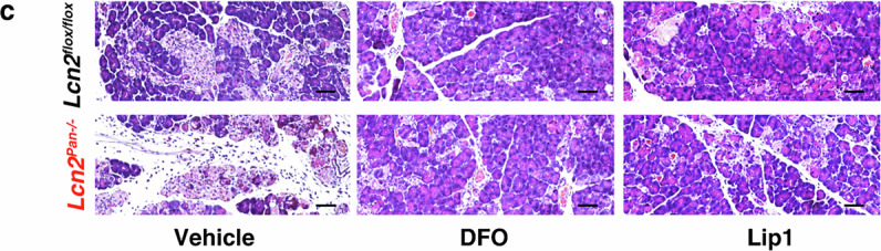 Author Correction: NUPR1 is a critical repressor of ferroptosis.
