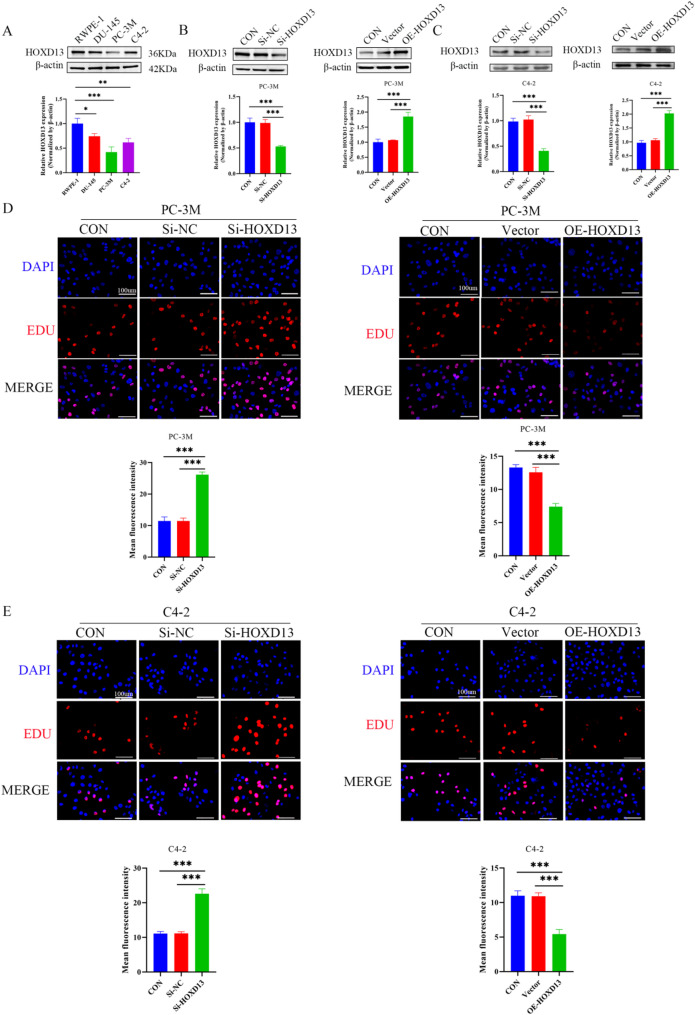 HOXD13 knockdown attenuates apoptosis in prostate cancer via the upregulation of MDM2/p53 signaling.