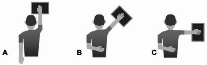 Investigation of the intra and inter-day reliability of the athletic shoulder test using the wii balance board in volleyball players.