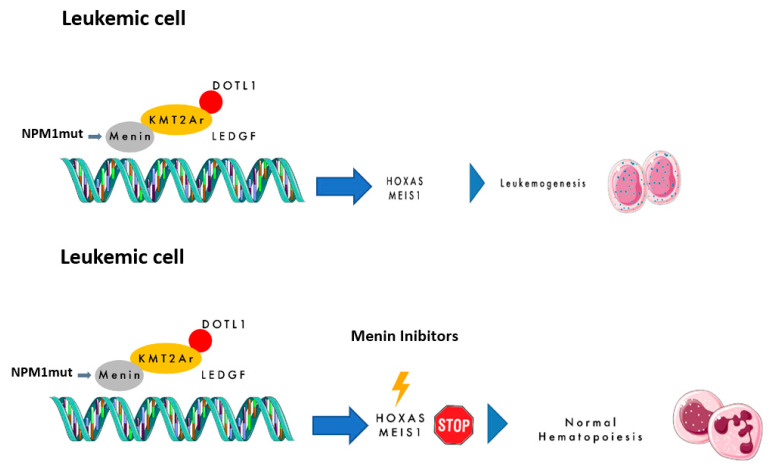 Therapeutic Implications of Menin Inhibitors in the Treatment of Acute Leukemia: A Critical Review.