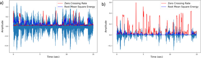 Automatic temporal analysis of speech: A quick and objective pipeline for the assessment of overt stuttering.