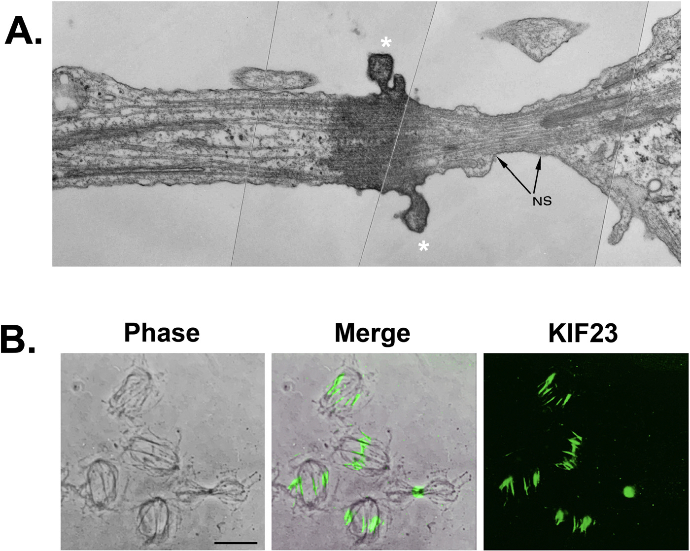 The midbody and midbody remnant: from cellular debris to signaling organelle with diagnostic and therapeutic potential.