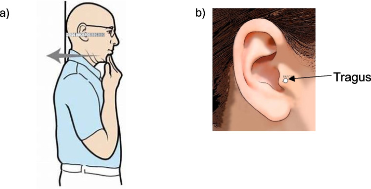 Acceptability of self-completion versus face-to-face use of a vertebral fragility fracture clinical decision tool for use in older people with back pain in the UK