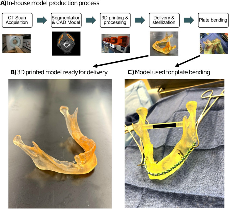Mandibular reconstruction outcomes for in-house patient-specific solutions.