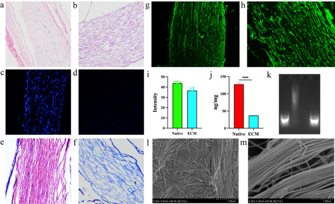 The role of Genipin crosslinked extracellular matrix loaded bFGF in the repair of peripheral nerve injury.