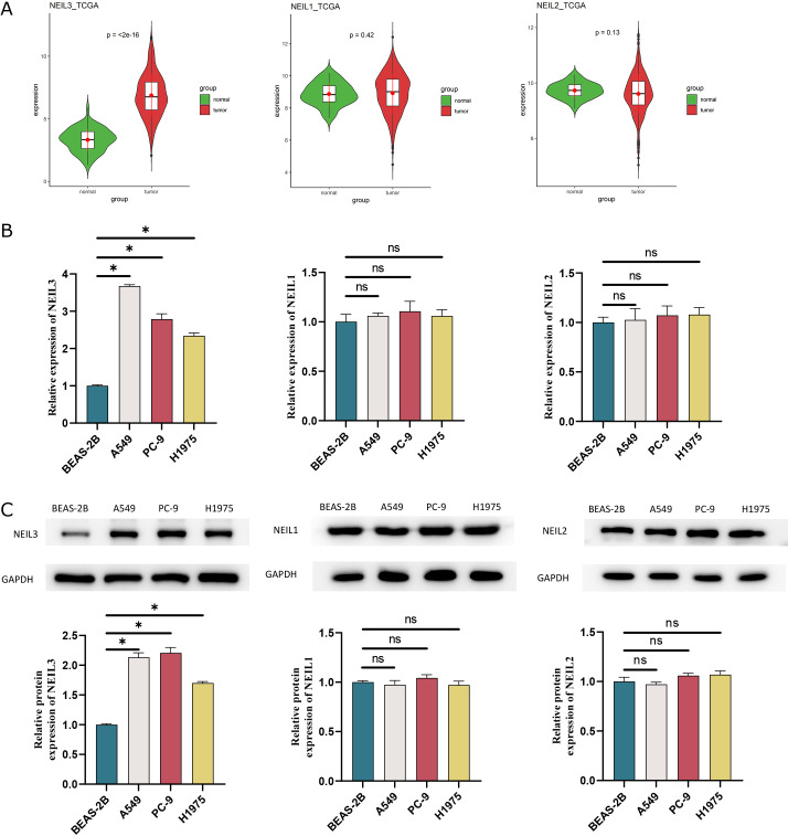 FOXM1 transcriptionally activates NEIL3 to inhibit ferroptosis in lung adenocarcinoma cells.