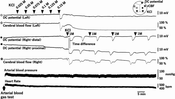 Effect of lacosamide on cortical spreading depolarization in mice.