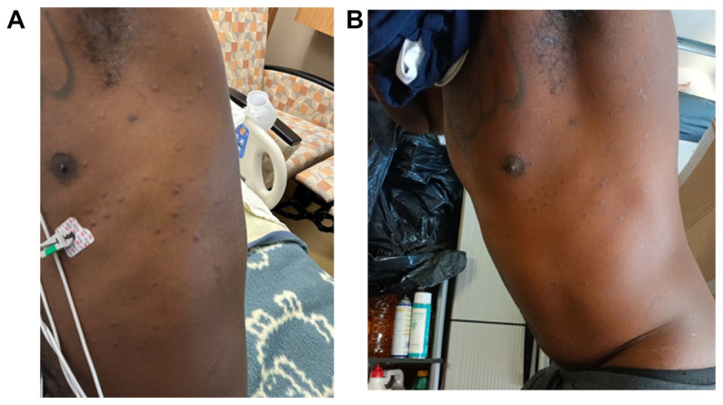 Diagnostic Challenges in Concurrent Primary Biliary Cholangitis and Secondary Syphilis: A Case Report.