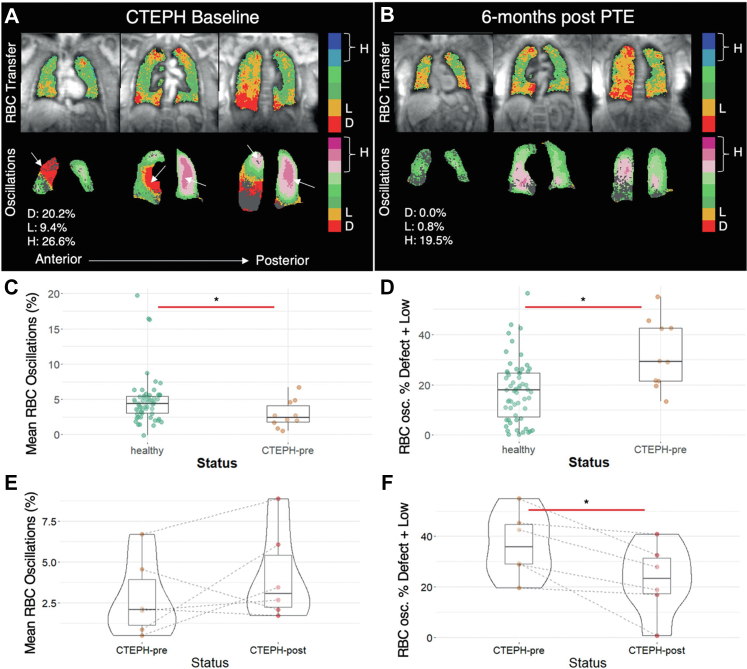 Small vessels, big problem: a dive into the pulmonary microcirculation in pulmonary hypertension and methods for evaluation.