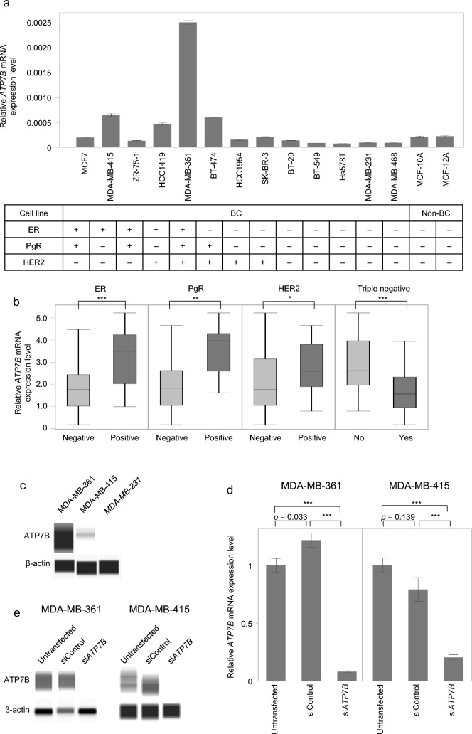 ATPase copper transporting beta attenuates malignant features with high expression as an indicator of favorable prognosis in breast cancer.