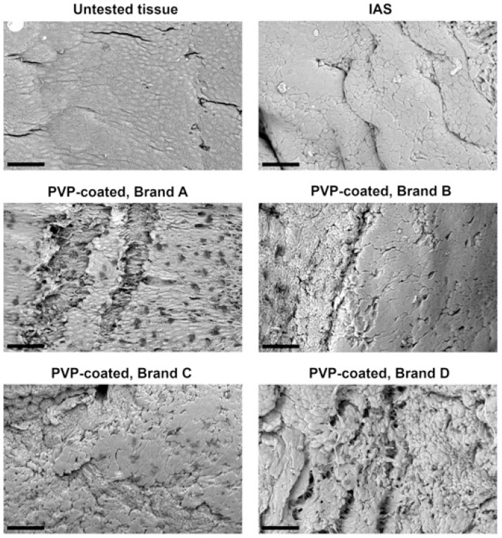 Intermittent Catheters with Integrated Amphiphilic Surfactant Reduce Urethral Microtrauma in an <i>Ex Vivo</i> Model Compared with Polyvinylpyrrolidone-Coated Intermittent Catheters.