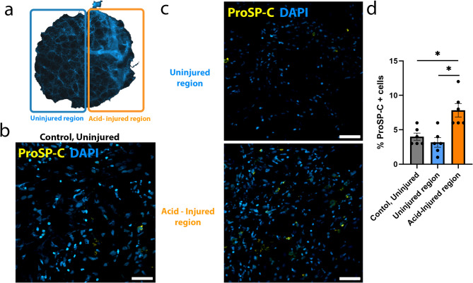 A human PCLS model of lung injury and repair for discovery and pharmaceutical research.