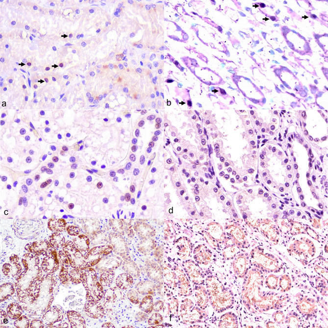 Pathological alteration and caspase-dependent activity of feline kidneys in natural infection of feline morbillivirus.