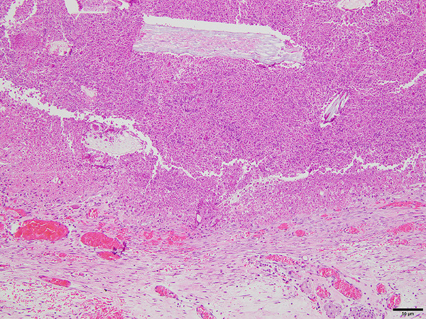 Pathogenesis, Surgical Treatment and Postoperative Outcome of Rabbits (Oryctolagus cuniculus) With Intraabdominal Abscess: 12 Cases (2017-2023).