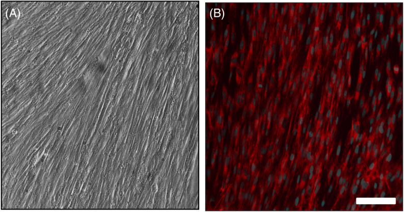 Early fiber development in human vocal folds: An in vitro pilot study.