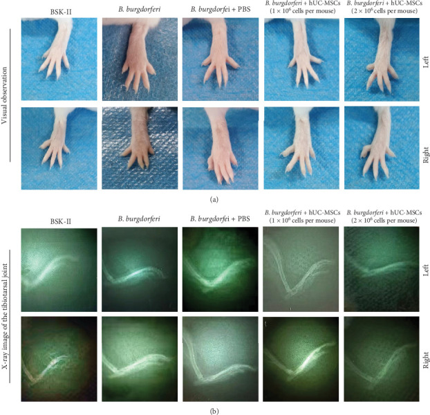 Mesenchymal Stem Cells Reduce Inflammation in a Mouse Model of Lyme Arthritis.