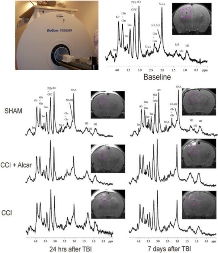 Longitudinal Brain Structural, Neurochemical, and Behavioral Changes Following Traumatic Brain Injury in Immature Rat Brain with ALCAR Treatment