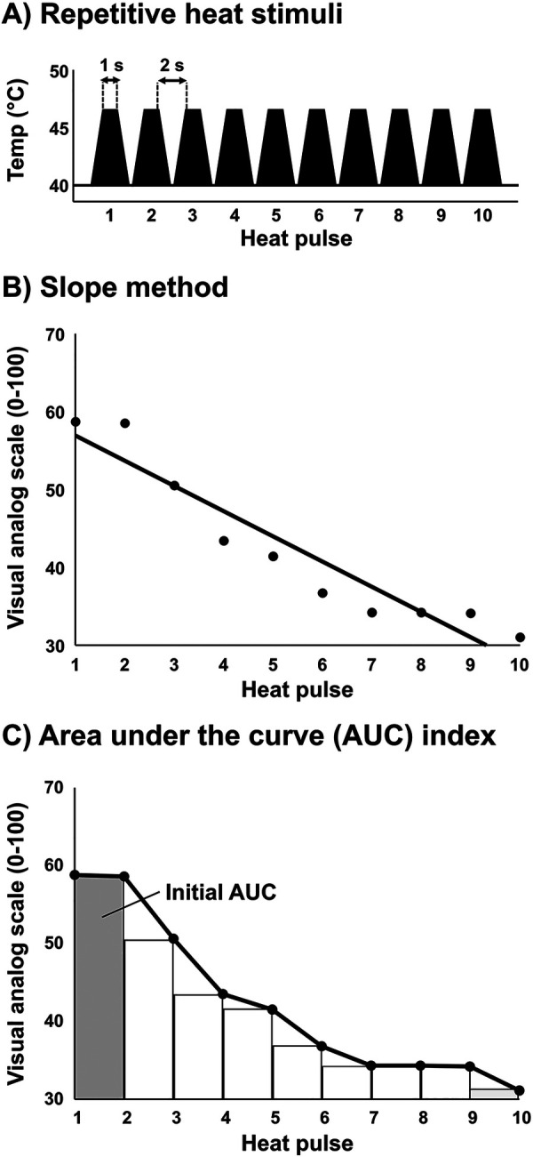 Anti-nociceptive properties of cardiopulmonary baroreceptors in patients with chronic back pain.