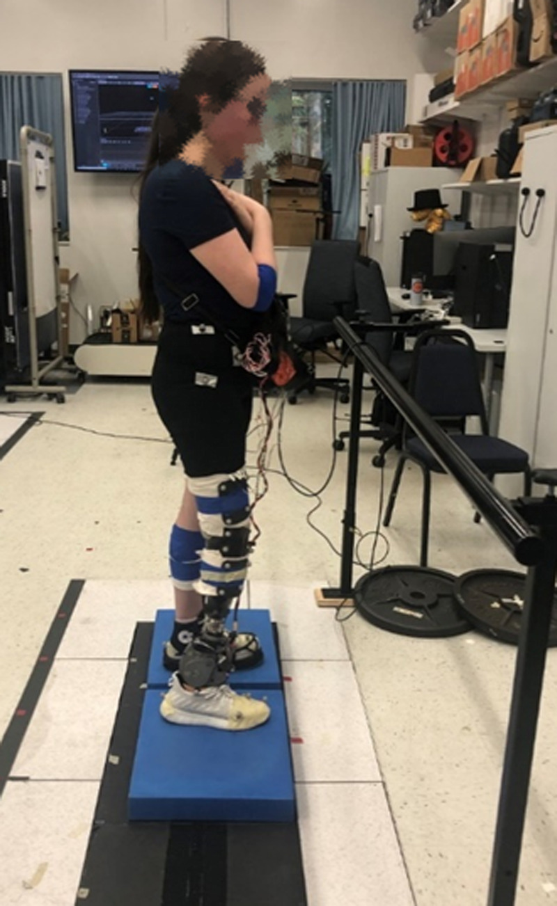 Evaluation of a Portable Bionic Ankle Prosthesis Under Direct Continuous Electromyography Control for Quiet Standing Tasks.