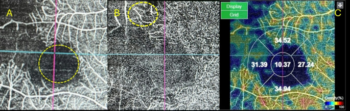 Abstract Image