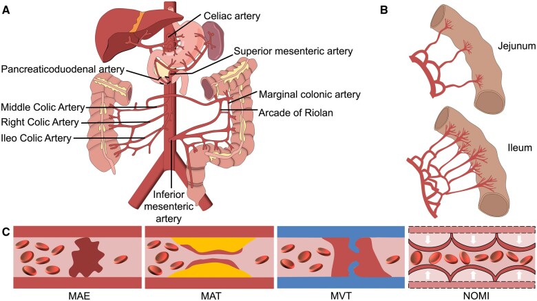 Tricky acute mesenteric ischemia: what can we do?