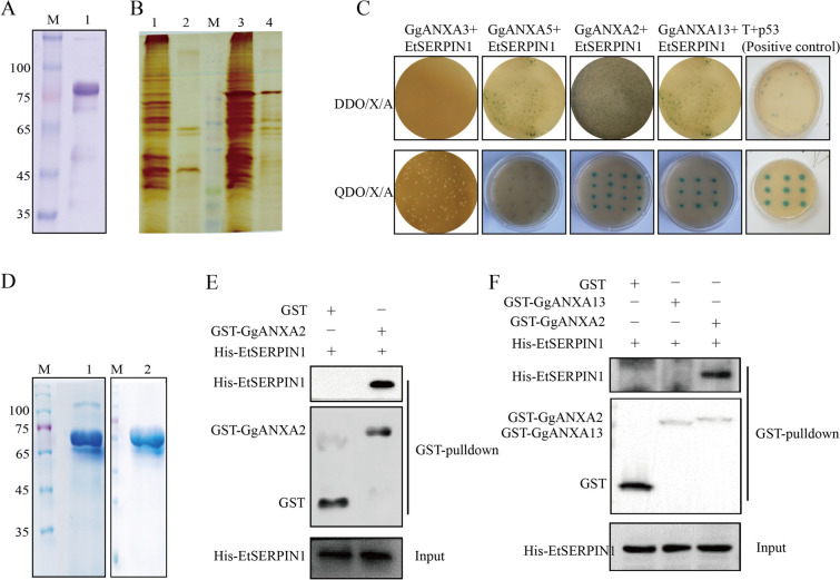EtSERPIN1 binding with chicken ANXA2 is essential for Eimeria tenella attachment and invasion process.