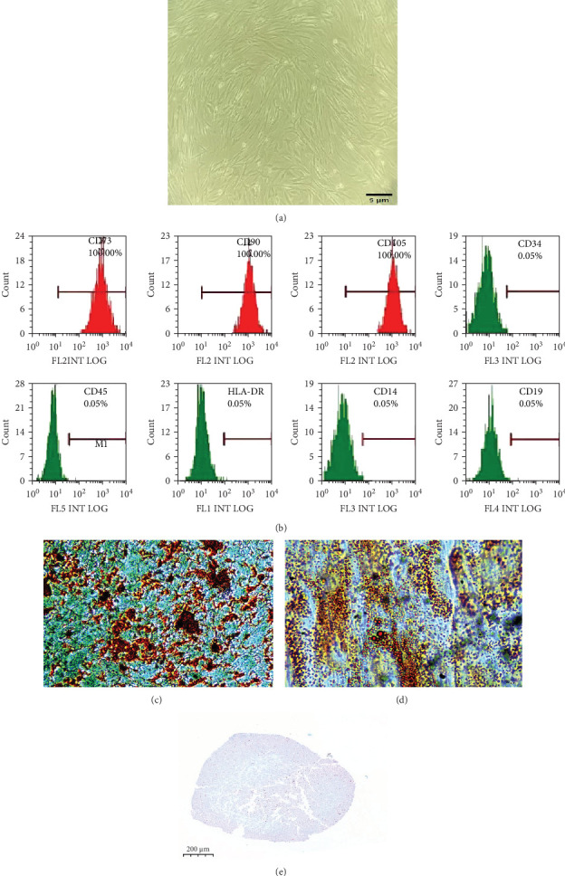 Mesenchymal Stem Cells Reduce Inflammation in a Mouse Model of Lyme Arthritis.