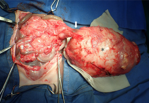 Pathogenesis, Surgical Treatment and Postoperative Outcome of Rabbits (Oryctolagus cuniculus) With Intraabdominal Abscess: 12 Cases (2017-2023).