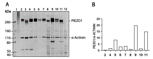 Western Blotting and Immunoprecipitation of Native Human PIEZO1 Channels.