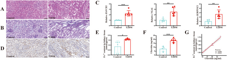 Urinary Ferritin as an Early Indicator of Tubular Injury in Diabetic Kidney Disease: Insights from NHANES and Clinical Cohorts.