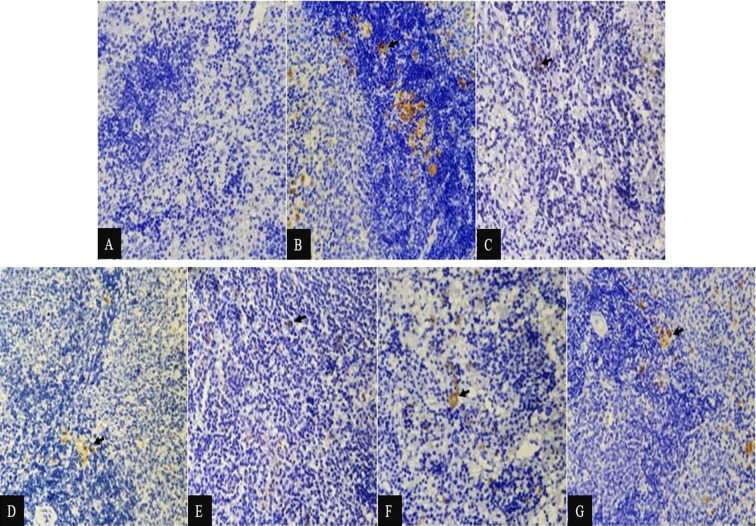 Impact of Sappan Wood Extract as Iron Chelator Adjuvant on Iron Concentration and Macrophage Polarization in Rat Spleen.