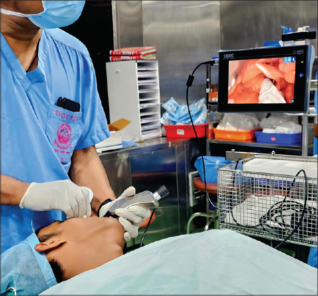 Effect of "LeHeR maneuver"on glottic view as assessed with POGO score during video laryngoscopy.