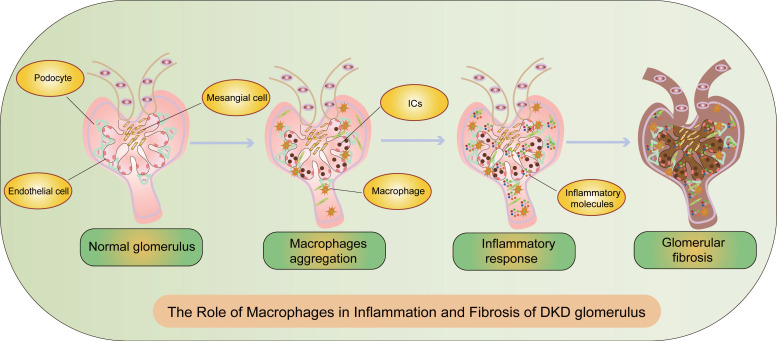 Macrophages in Focus: Key Drivers and Therapeutic Opportunities in Diabetic Kidney Disease.