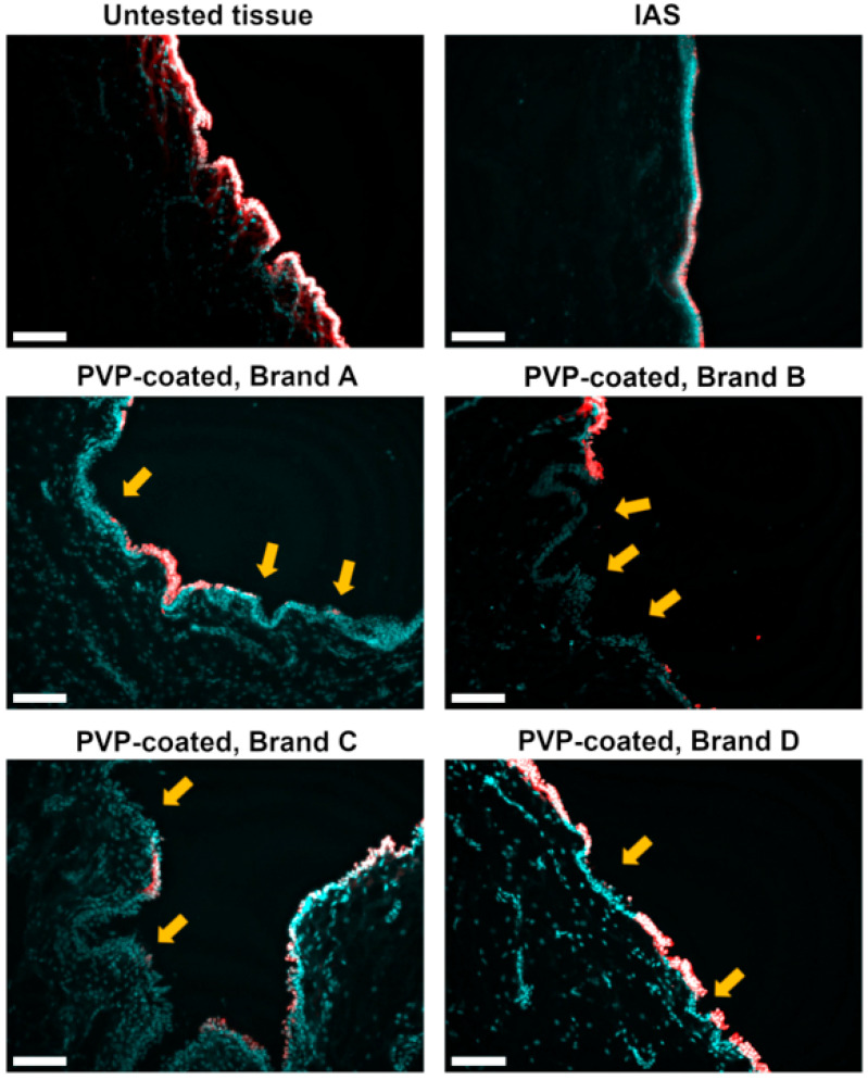 Intermittent Catheters with Integrated Amphiphilic Surfactant Reduce Urethral Microtrauma in an <i>Ex Vivo</i> Model Compared with Polyvinylpyrrolidone-Coated Intermittent Catheters.