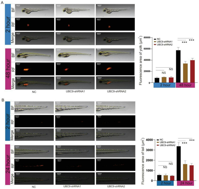 UBC9 overexpression promotes proliferation and metastasis in gastric cancer via ATF2.