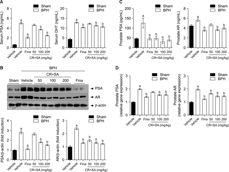 The Combination of <i>Curcumae Radix</i> and Syzygium Aromaticum Extracts Mitigates Benign Prostatic Hyperplasia through Anti-Proliferative and Anti-Inflammatory Effects.