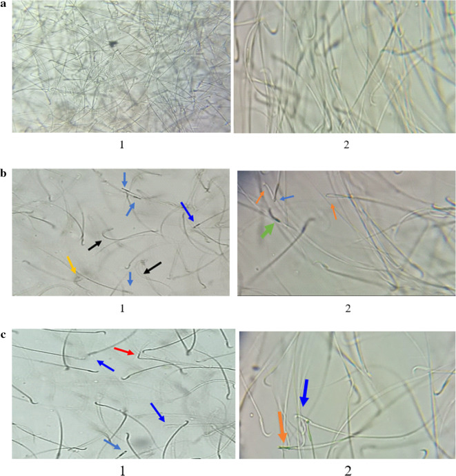 Role of Allium cepa and Allium sativum extracts in oxidative stress, sperm parameters and histological abnormalities induced by deep-frying oil in testis.