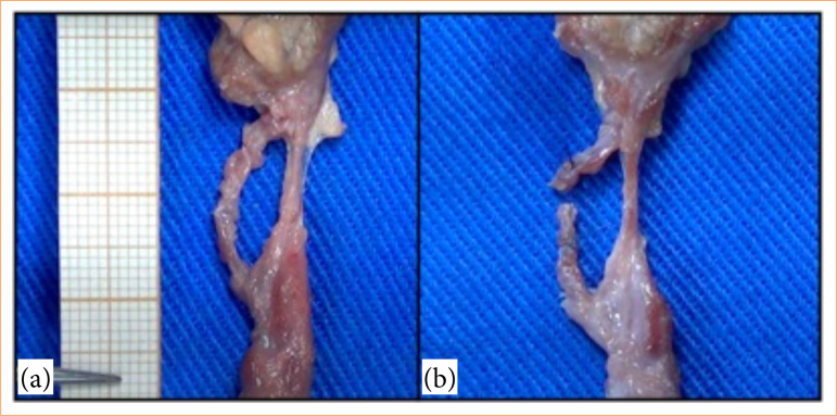"Gotta have balls": bovine testicles and video magnification imaging in the varicocelectomy training.