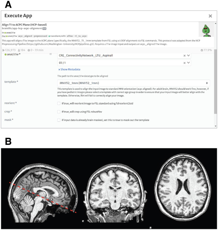 Breaking barriers: broadening neuroscience education via cloud platforms and course-based undergraduate research.