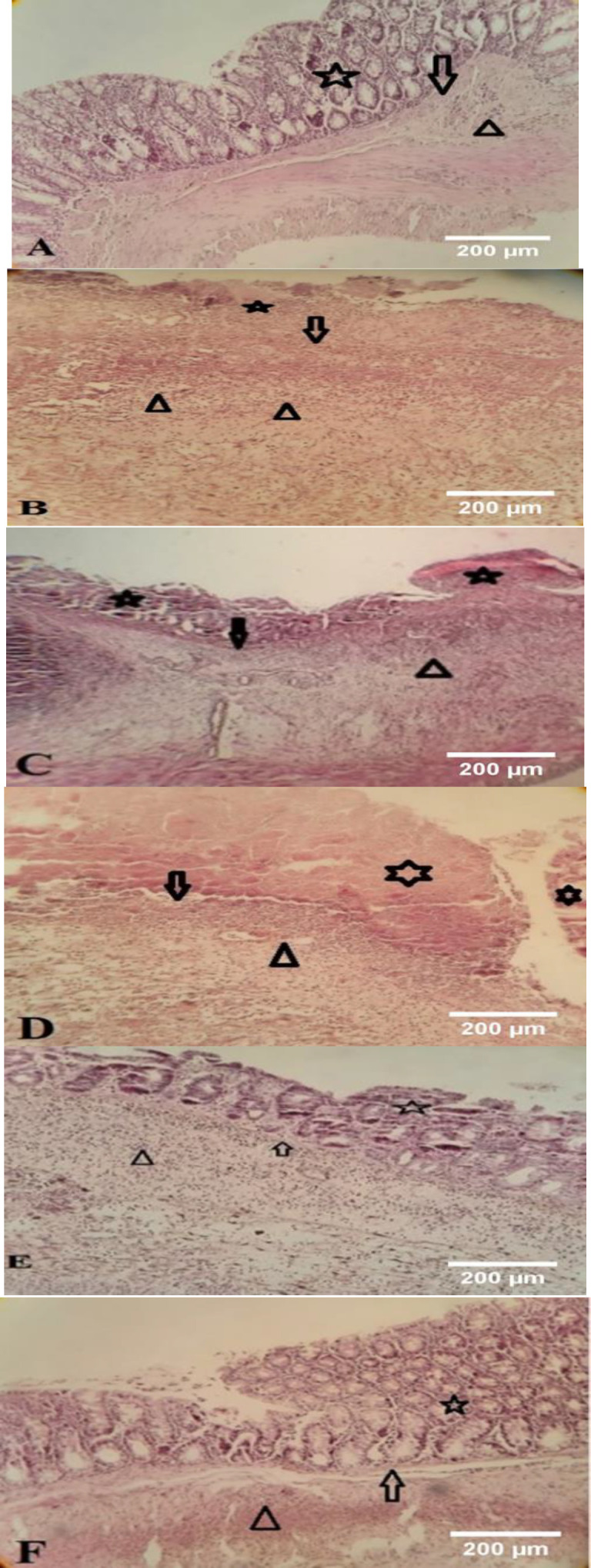 Protective effect of Henna (<i>Lawsonia inermis</i> L.<i>)</i> fixed oil (a Persian medicine preparation) on acetic acid-induced ulcerative colitis in rats.