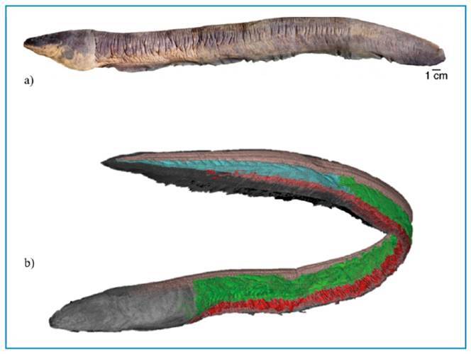 Two Clinical Records of Human Injuries with a Death caused by Electric Eels Electrophorus spp. Gill, 1864.