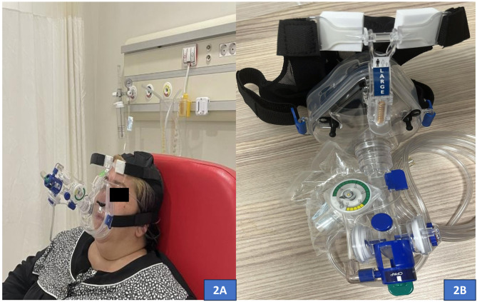 Comparison of positive expiratory pressure device versus non-invasive ventilation on outcomes in acute exacerbation of chronic obstructive pulmonary disease in the emergency department.