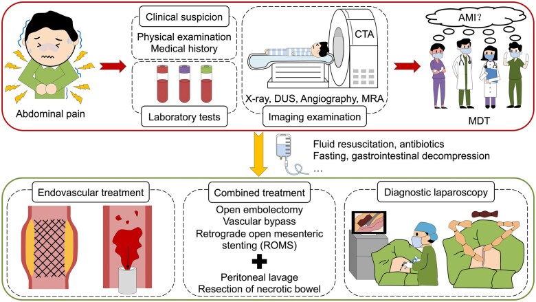 Tricky acute mesenteric ischemia: what can we do?