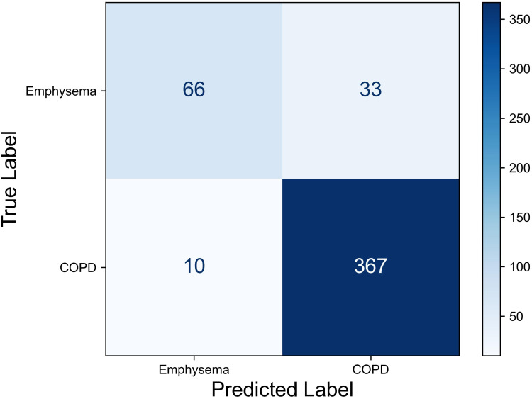 Differentiating Emphysema From Emphysema-Dominated COPD Patients with CT Imaging Feature and Machine Learning.