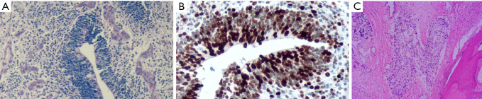 Clinical insights from the management of a giant immature teratoma in an infant-a case report.
