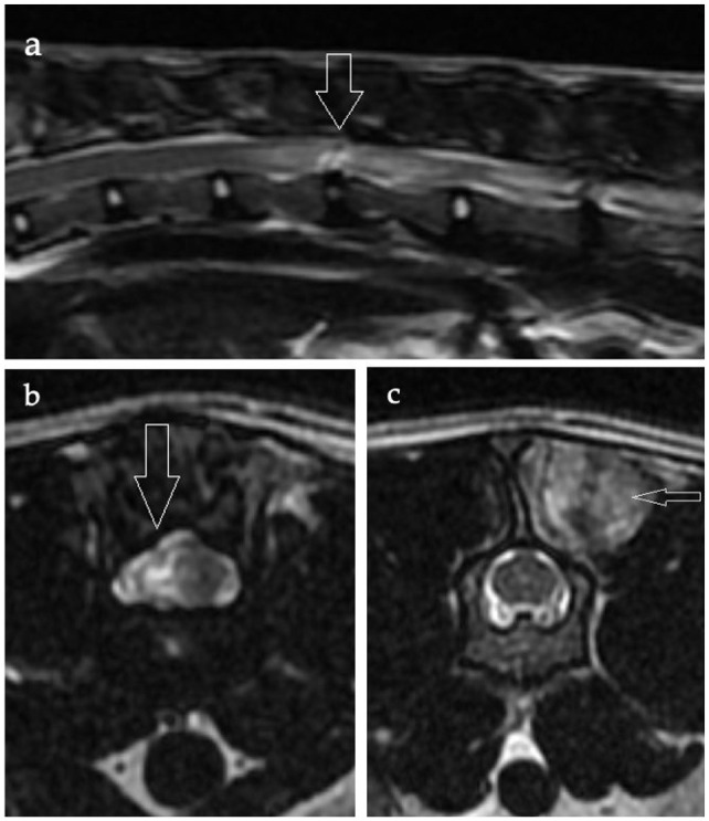 Presumptive intramedullary intervertebral disc extrusion in 12 cats: clinical presentation, MRI findings, treatment and outcome.
