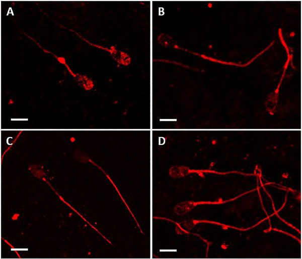 Presence and Location of CatSper 1-4, Opioid (μ, δ and κ) and CD44 Receptors in SPERMATOZOA from AOUDAD, IBERIAN IBEX and Mouflon.