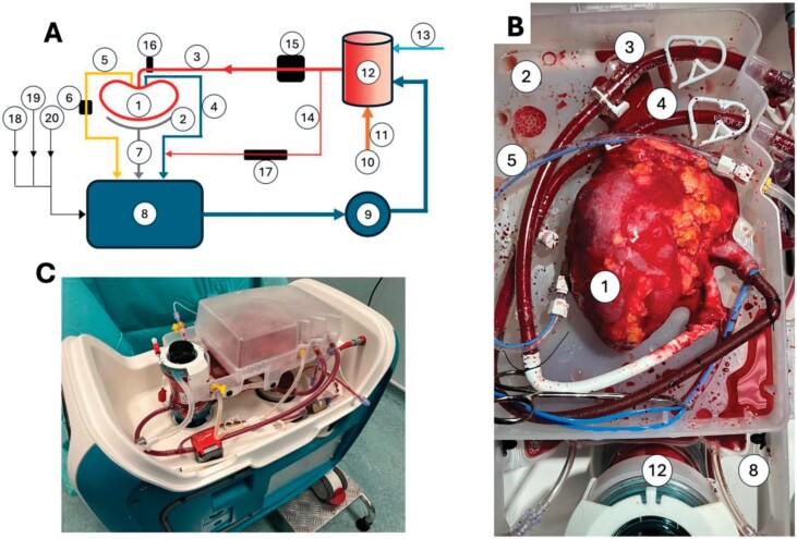 Prolonged normothermic perfusion: a promising approach to kidney transplantation.